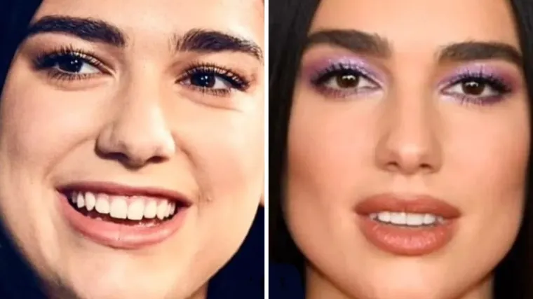 Pogledajte kako je Dua Lipa izgledala prije nego &scaron;to je postala svjetska zvijezda