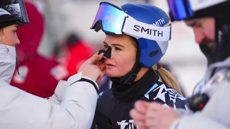 Jedna od najzgodnijih skija&scaron;ica iznenadila crnim predmetom na licu: Pogledajte o čemu se radi