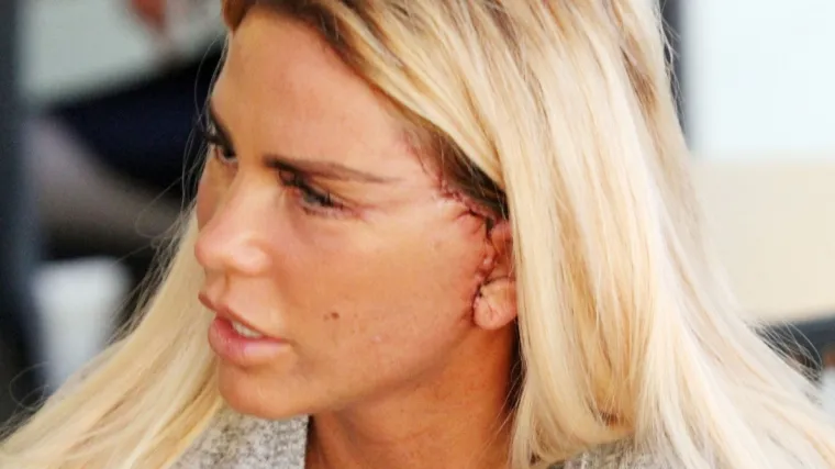 Estetski zahvati koji su &scaron;okirali svijet: Kako je reality zvijezda uni&scaron;tila prirodnu ljepotu?